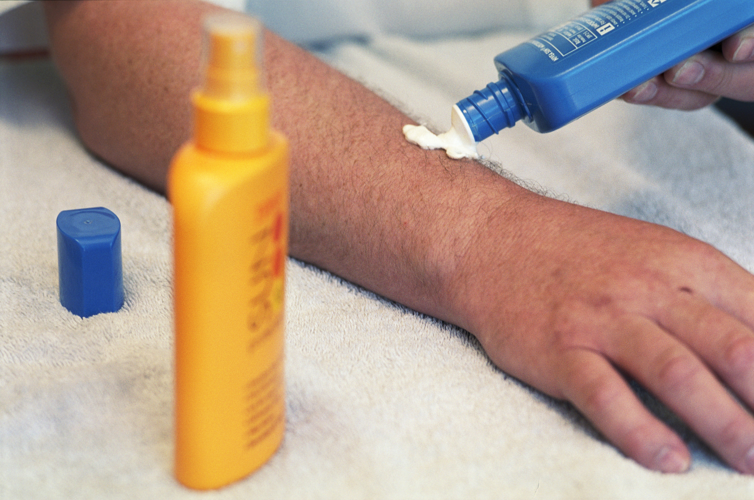 Unique ID: ytri000502 Caption: Person applying sun protection lotion to arm/ skin. Restrictions: NHS Photo Library - for use in NHS, local authority Social Care services and Department of Health material only Copyright: ©Crown Copyright