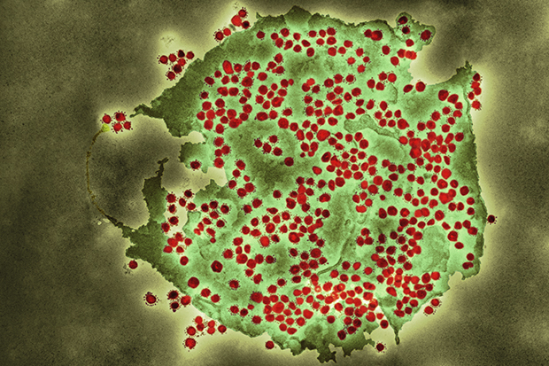 Coloured transmission electron micrograph (TEM) of a SARS-CoV-2 coronavirus particle 
